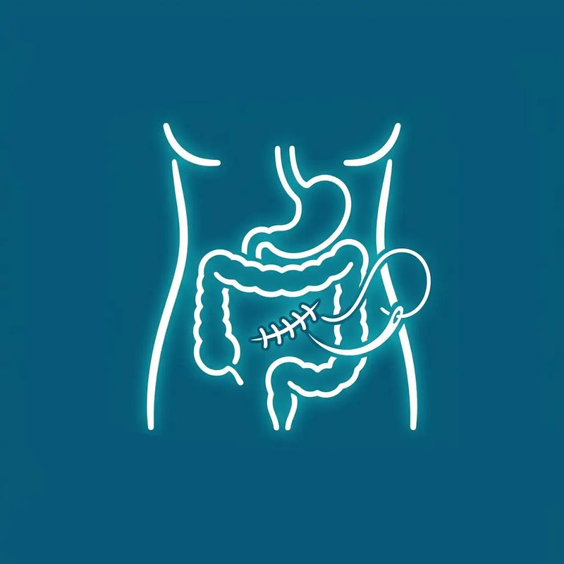 GENERAL SURGERY SUTURES