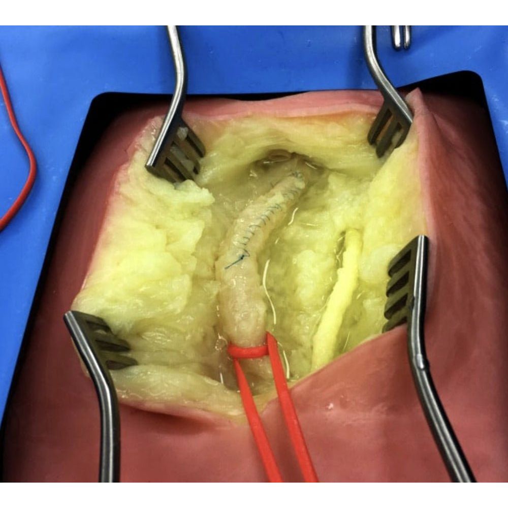 Embedded Femoral Groin Model | Femoral Endarterectomy Training Simulator - Surgical TrainingLL-TRN-0250