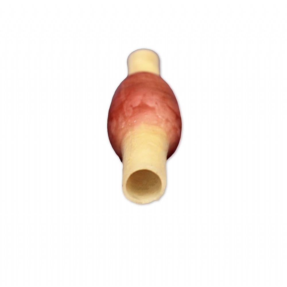 Ectopic Pregnancy Model | OB - GYN Surgical Training Simulator - Surgical TrainingLL-TRN-0507