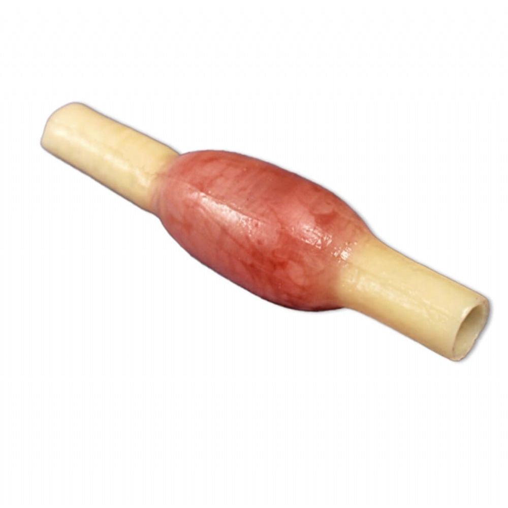 Ectopic Pregnancy Model | OB - GYN Surgical Training Simulator - Surgical TrainingLL-TRN-0507