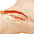 Carotid Head Simulator – Vascular Surgery Training Model – Carotid Endarterectomy Practice – Realistic Surgical Simulation Head – (Professional Training Use) - Surgical TrainingSIM-CAROTID-HEAD-VASC-01