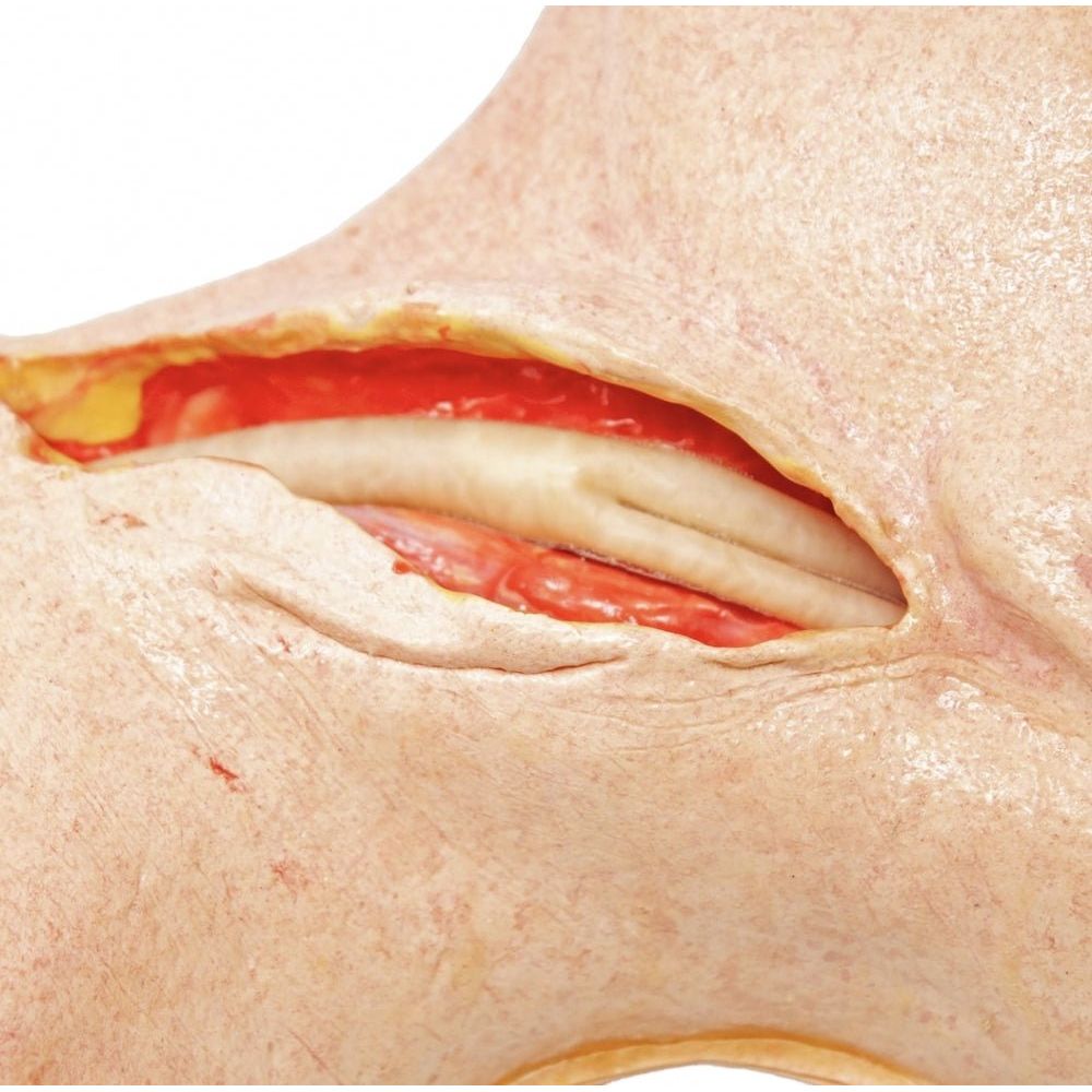 Carotid Head Simulator – Vascular Surgery Training Model – Carotid Endarterectomy Practice – Realistic Surgical Simulation Head – (Professional Training Use) - Surgical TrainingSIM-CAROTID-HEAD-VASC-01