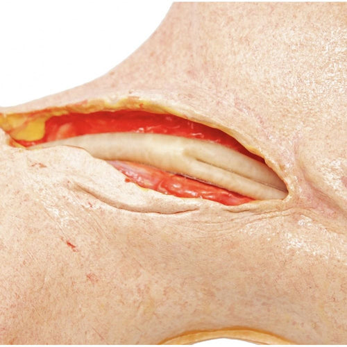 Carotid Head Simulator – Vascular Surgery Training Model – Carotid Endarterectomy Practice – Realistic Surgical Simulation Head – (Professional Training Use) - Surgical TrainingSIM-CAROTID-HEAD-VASC-01