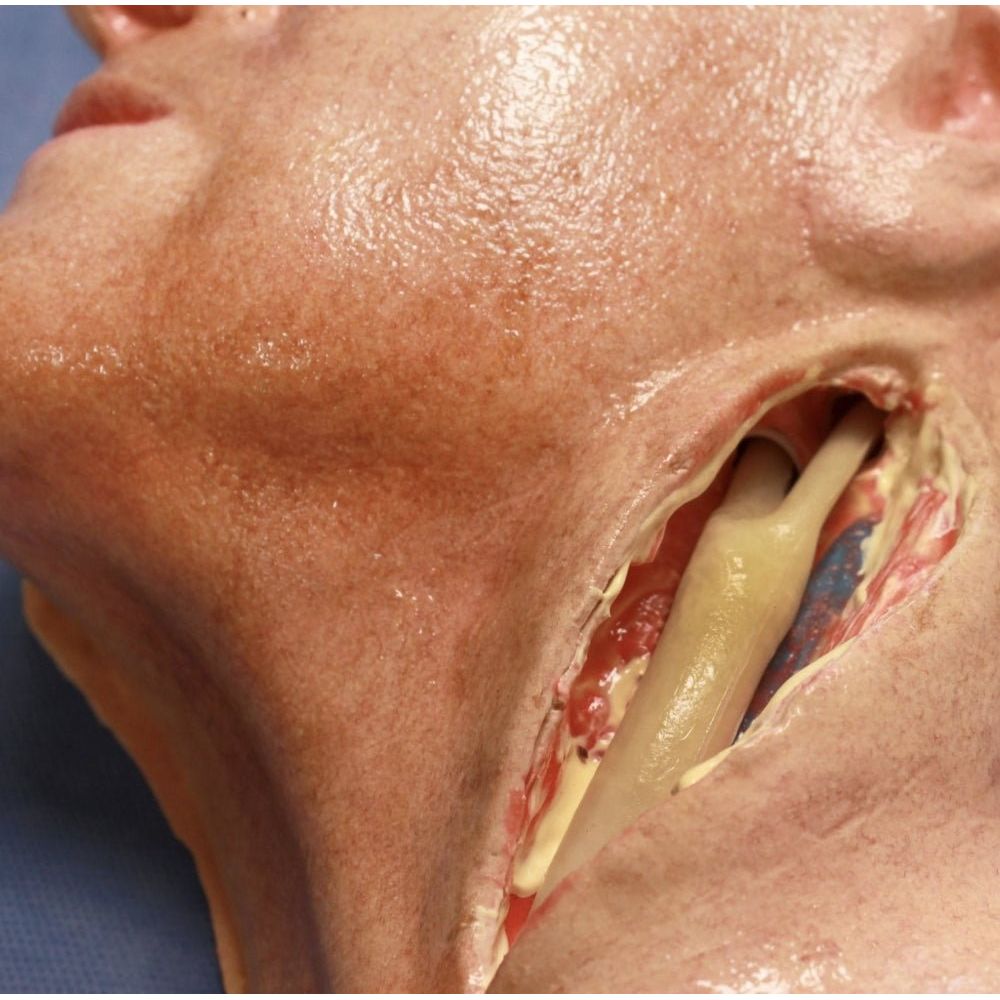 Carotid Head Simulator – Vascular Surgery Training Model – Carotid Endarterectomy Practice – Realistic Surgical Simulation Head – (Professional Training Use) - Surgical TrainingSIM-CAROTID-HEAD-VASC-01